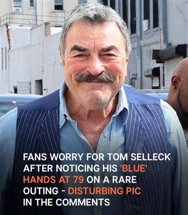 Fans Worry for Tom Selleck, 79, after Seeing His 'Blue' Hand on a Rare Outing 'What Is That on